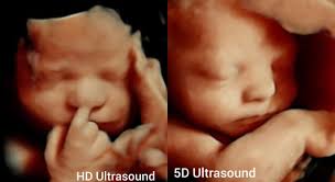ultrasound studio scan