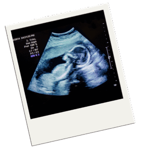 2 D Ultrasound Gender Scan - Baby Tyme Ultrasound Studio