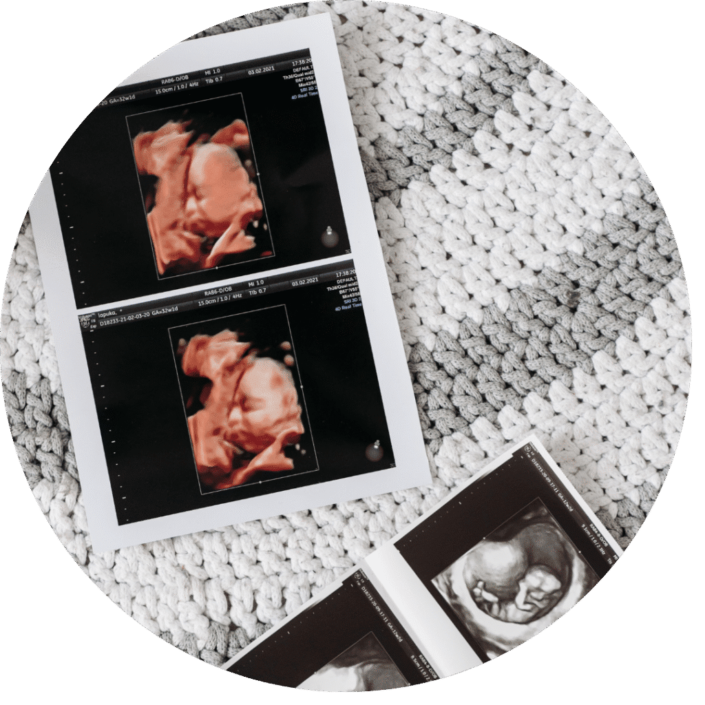 3D/4D Ultrasound Scans in Johannesburg