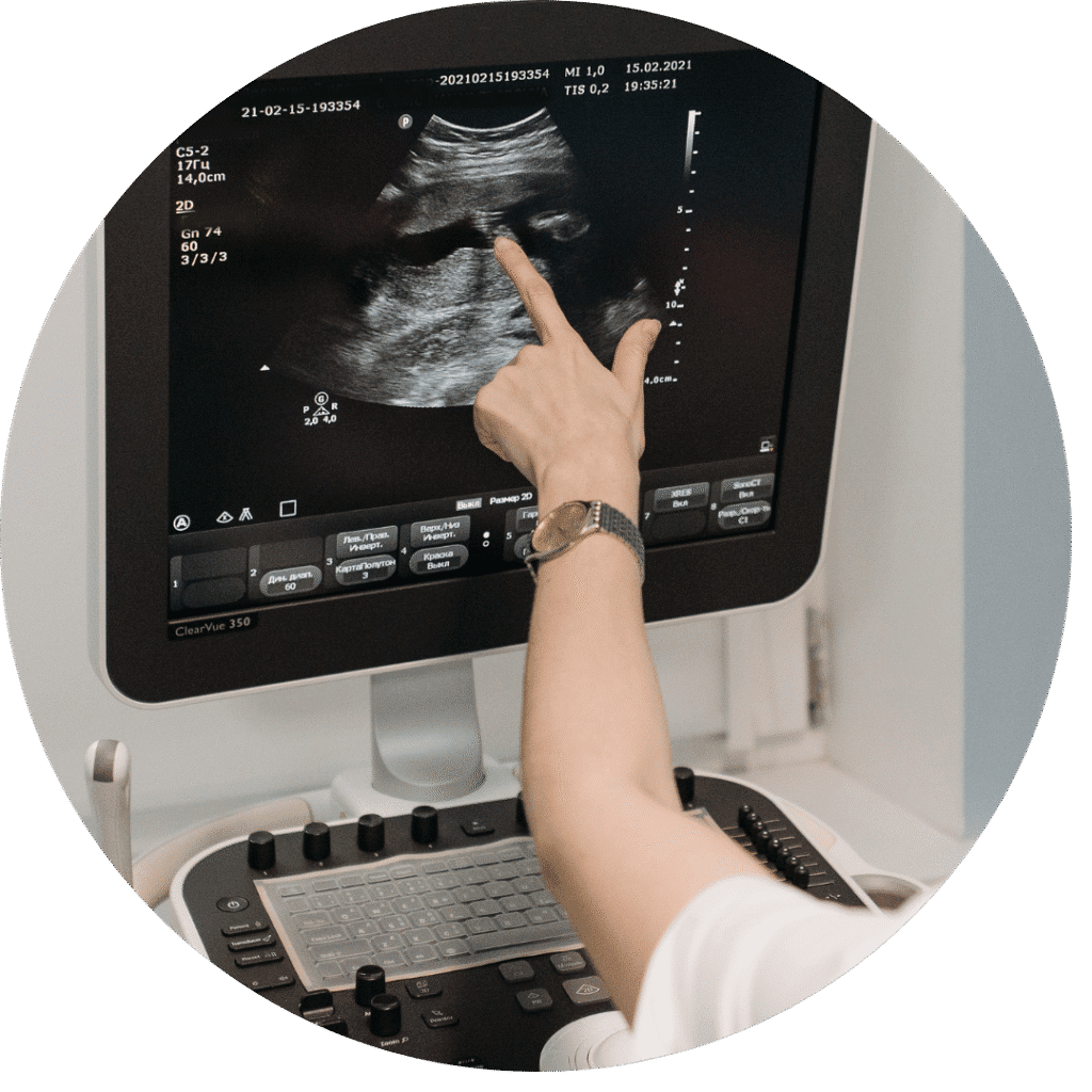 Baby Tyme Kyalami - Early Pregnancy Ultrasound Scan