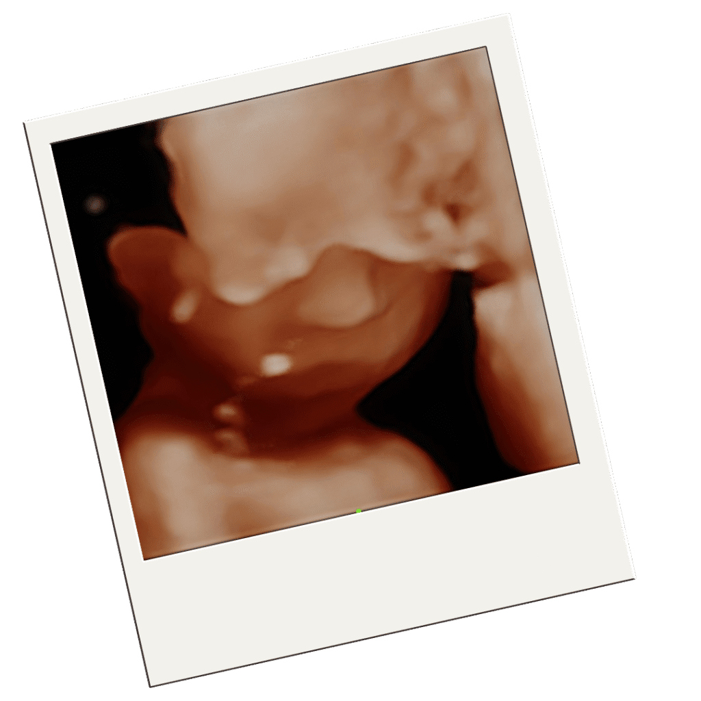 HD Ultrasound Scan - Baby Tyme Ultrasound Studio