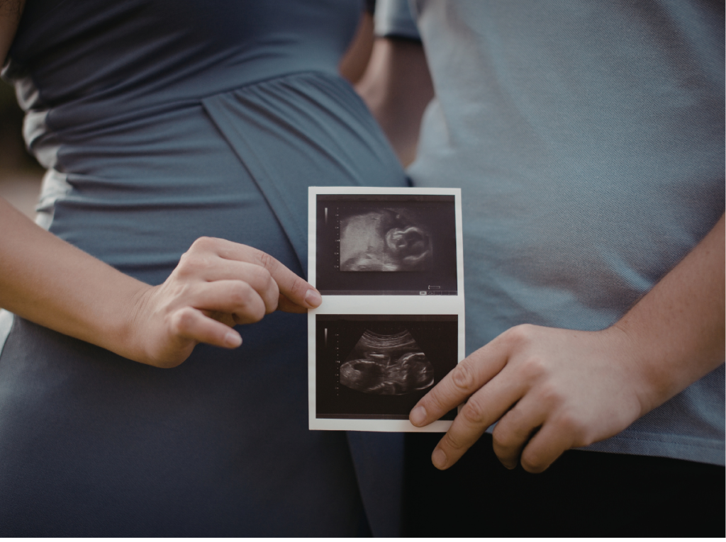 2D First Trimester Scan in Kyalami