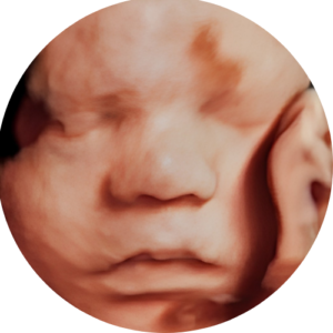 Baby Tyme Kyalami - 3D4D Scans