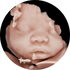 Baby Tyme Kyalami - HD5D Scans