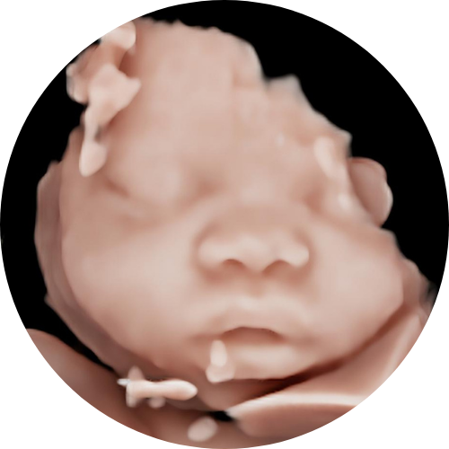 Baby Tyme Kyalami - HD5D Scans